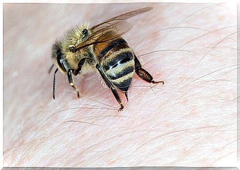 bee stinging 